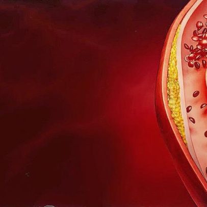 Diretriz atualizada recomenda metas mais rigorosas para controle do colesterol