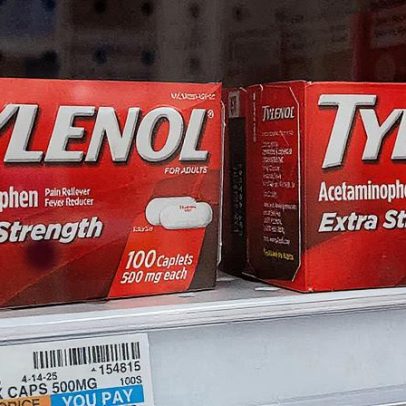 Governo Trump liga uso de Tylenol durante a gravidez ao autismo em crianças
