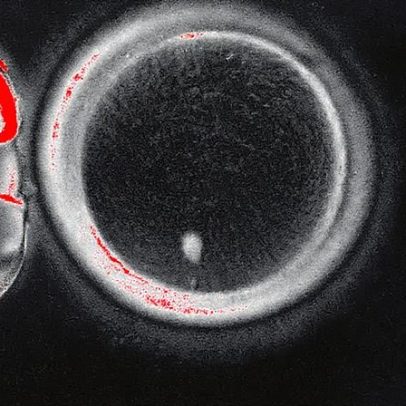 Cientistas produzem óvulos fecundáveis a partir de células da pele humana
