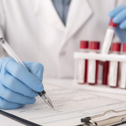 Exame de sangue testado no Brasil identifica a presença de Alzheimer com mais de 90% de precisão