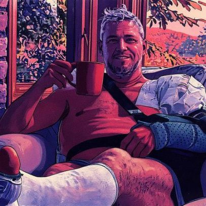 Ant Anstead revela detalhes das lesões que sofreu ao jogar futebol
