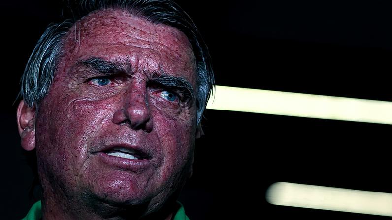 Gilson Machado alerta para o estado de saúde de Bolsonaro e critica disputas internas na direita. (Foto: Fábio Rodrigues Pozzebom/Agência Brasil)