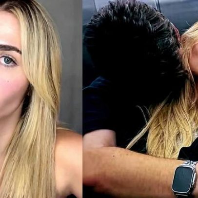 Eliezer relembra fotos de antes e depois da transformação do sorriso e choca web