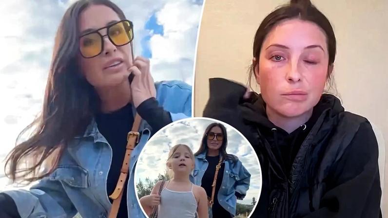 Bristol Palin revealed she still has a “crooked face” one year after developing a neurological disorder that caused facial paralysis. bsmp2/Instagram