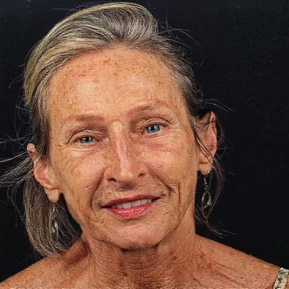 Pianista brasileira afirma que dados sumiram e só resta dormir na porta da AIMA