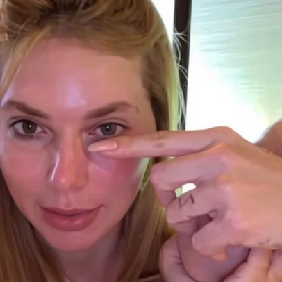 Virginia Fonseca machuca o olho ao brincar com a filha