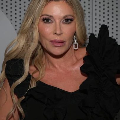 Brandi Glanville divulga nova atualização de saúde após batalha com desfiguração
