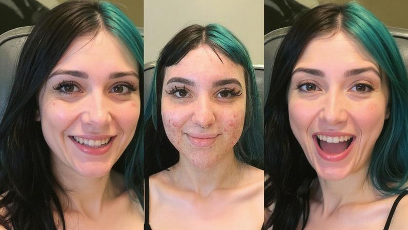 Influenciadora Belle Belinha faz harmonização facial — Foto: Reprodução/ Instagram