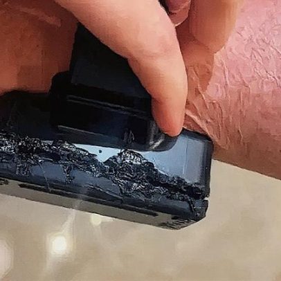 Bolsonaro afirma ter usado ferro de solda em tornozeleira