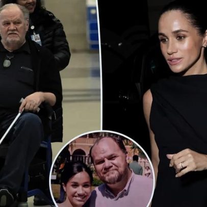 Thomas Markle, pai afastado de Meghan, tem perna amputada após pé ficar preto