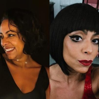 Samantha Schmütz exibe novo visual após procedimento com médico de Kim Kardashian