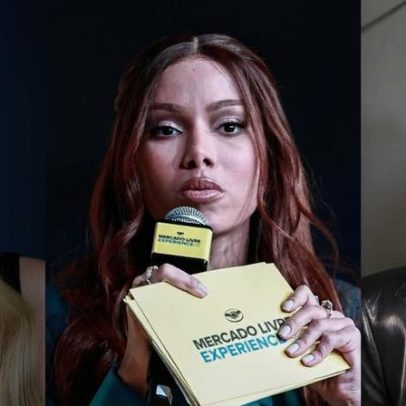 Médico analisa mudanças de Anitta, Kris Jenner e outras famosas
