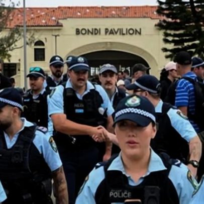 Policial ferido em ataque Bondi perde visão de um olho; dúvidas sobre segurança na Hanucá