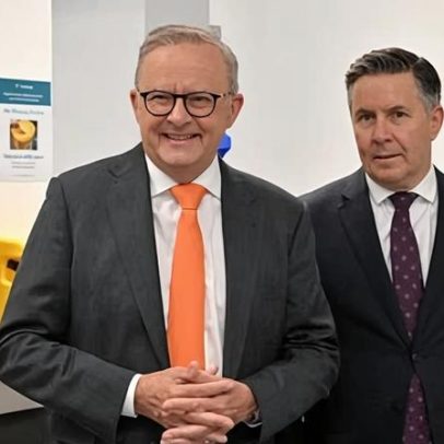 Albanese pede estados aceitar acordo de saúde de 20 bilhões idosos pressionam hospitais