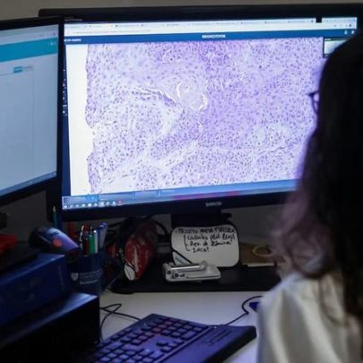 Quatro apostas em imunoterapia para câncer prometem revolucionar tratamento