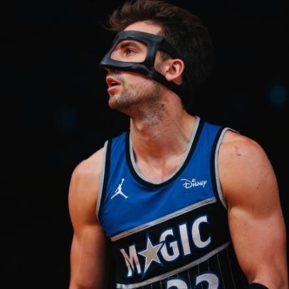 Magic confirma lesão de Franz Wagner e desfalque