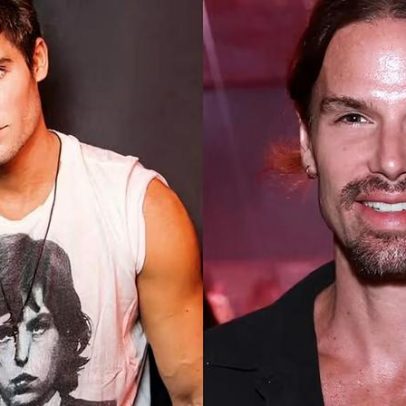 7 artistas repercutem nas redes por procedimentos estéticos em 2025