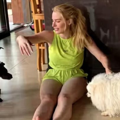Ex-BBB Fernanda Keulla visita terra natal após descoberta de doença rara
