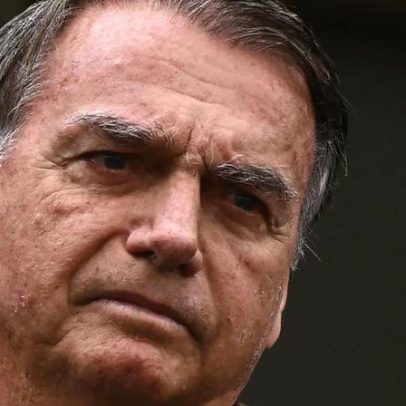 Bolsonaro precisa de internação hospitalar para cirurgia