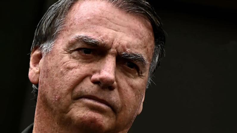 Perícia médica da PF concluiu que Bolsonaro precisa de cirurgia para tratar o quadro de soluços crônicos “o mais breve possível”. (Foto: EFE/Andre Borges)