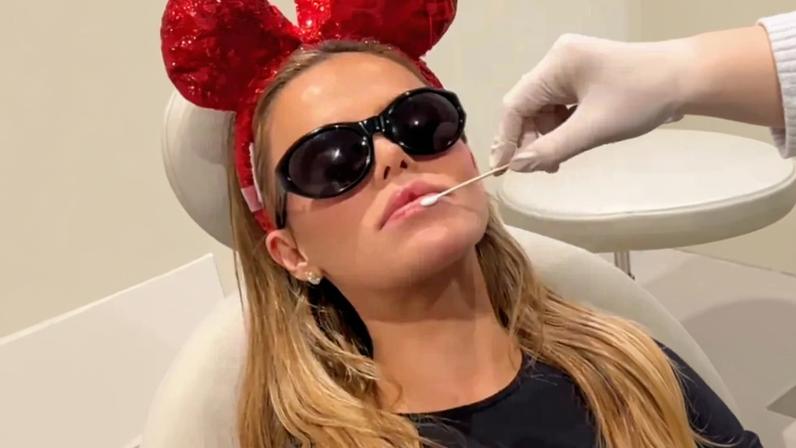 Brooks Nader dissolveu preenchimentos labiais como presente de Natal aos pais