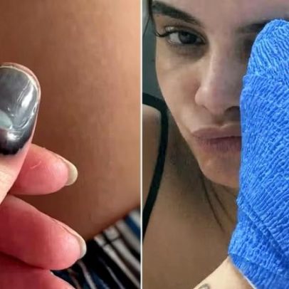 Carol Macedo passa por cirurgia após prender dedo na porta do carro