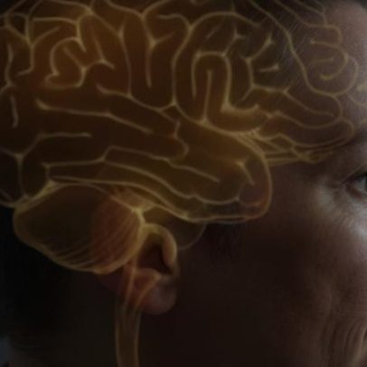 Projeto Ártemis analisa genética de pacientes que sofreram AVC