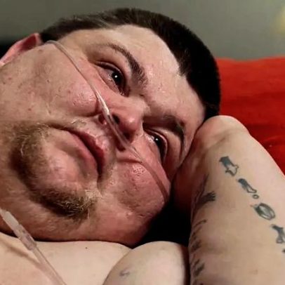 Cillas, com 330 kg, não sai da cama e busca tratamento médico