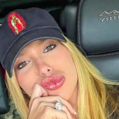 Rainha de bateria da Grande Rio revela problemas de pele ligados ao Carnaval