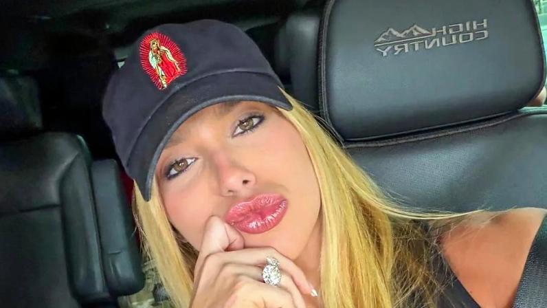 Virgínia Fonseca revela problemas de pele por ansiedade às vésperas do Carnaval: 'Toda hora que eu acho que vai melhorar...'