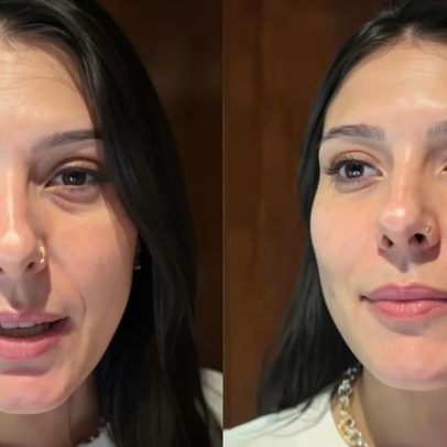 Ana Castela é diagnosticada com conjuntivite após olho inchado