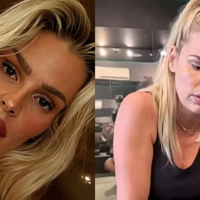 Yasmin Brunet fala sobre lipedema e corpo antes do diagnóstico