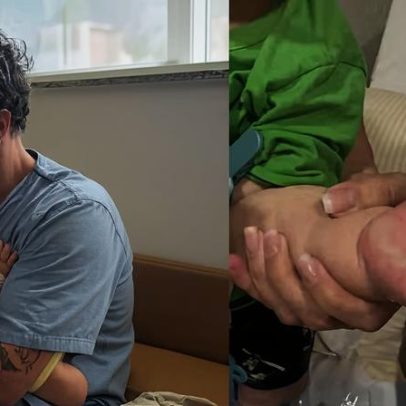 Eliezer atualiza estado de Ravi após acidente doméstico