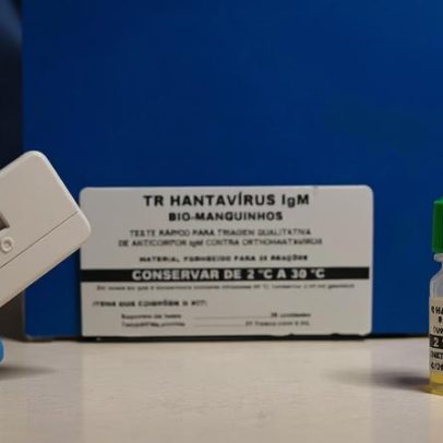 Novo teste permite diagnóstico de hantavirose em 20 minutos