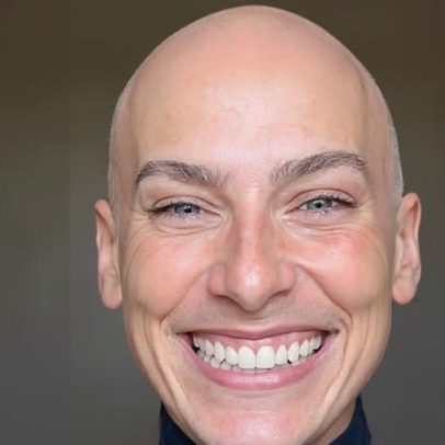 Atriz Dani Gondim revela câncer após filme sobre jornalista Marina Alves