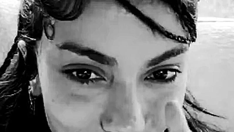 Anitta reage a pergunta sobre 'novo rosto' após cirurgias plásticas