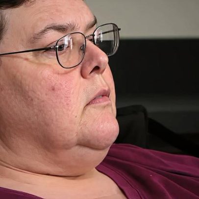 Holly, que pesava 300 kg, está estável após duas cirurgias