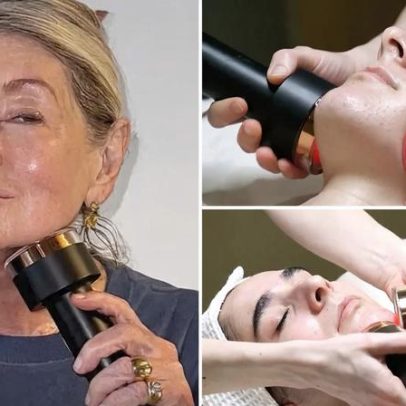 Avaliação do Lyma Lift: laser facial que atrai fãs, incluindo Martha Stewart