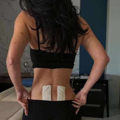 Kylie Jenner revela tratamento para dores nas costas e intriga internautas