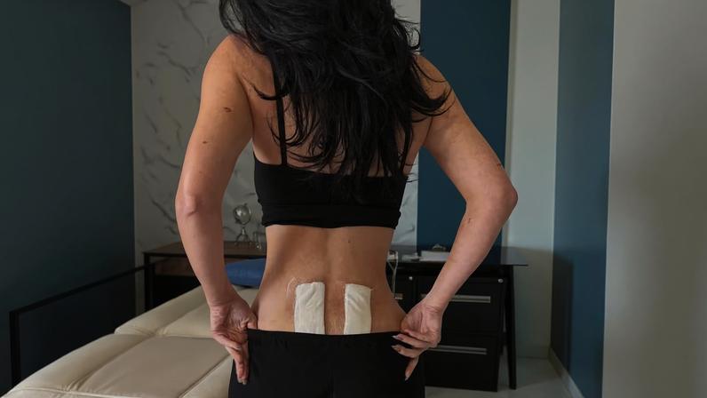 Kylie Jenner exibe bumbum mais 'discreto' ao mostrar tratamento para dores nas costas e intriga internautas — Foto: Reprodução/ Instagram