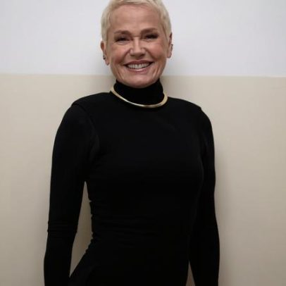 Xuxa recebe alta após cirurgia na coluna lombar em São Paulo