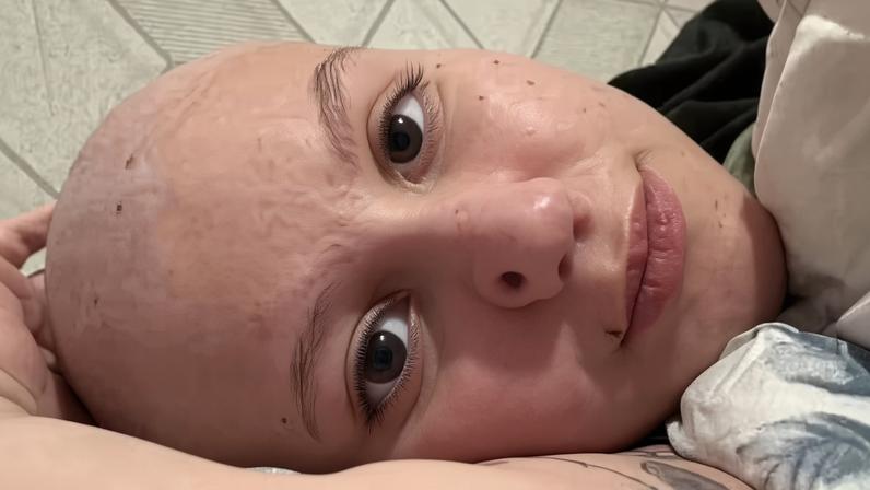 Isabel Veloso começou o tratamento oncológico aos 15 anos — Foto: Reprodução/Instagram