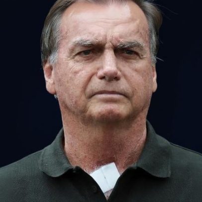 Bolsonaro tem novo pico de pressão e inicia tratamento da apneia, diz Carlos