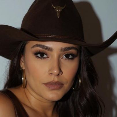 Lauana Prado faz harmonização facial: veja o antes e depois