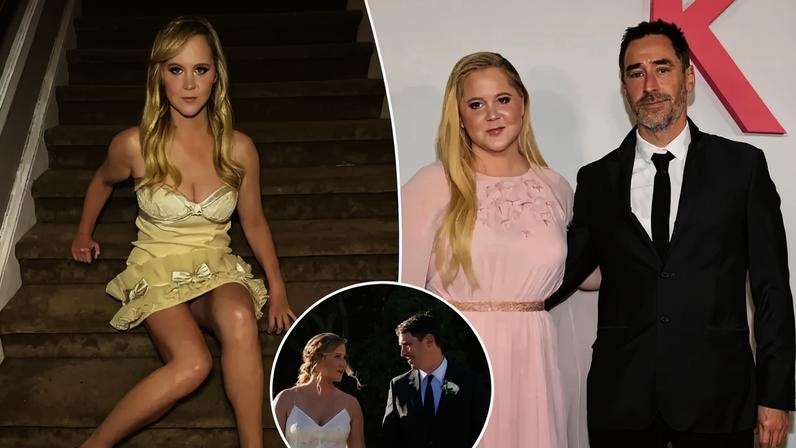 Amy Schumer has lost 50 pounds thanks to Mounjaro and liposuction. Instagram/amyschumer