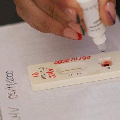 Ação no DF oferece teste rápido e informações sobre HIV/Aids