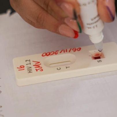 Brasil celebra avanços no combate ao HIV no Dia Mundial de Luta contra o HIV