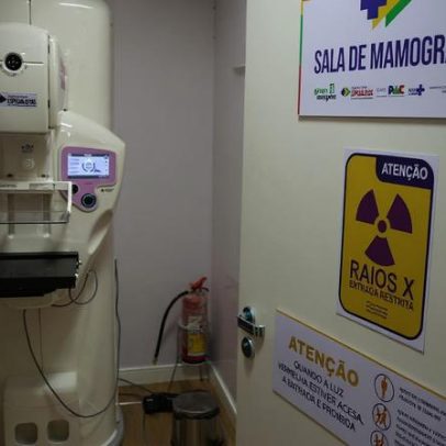 Lei garante mamografia pelo SUS para mulheres a partir de 40 anos