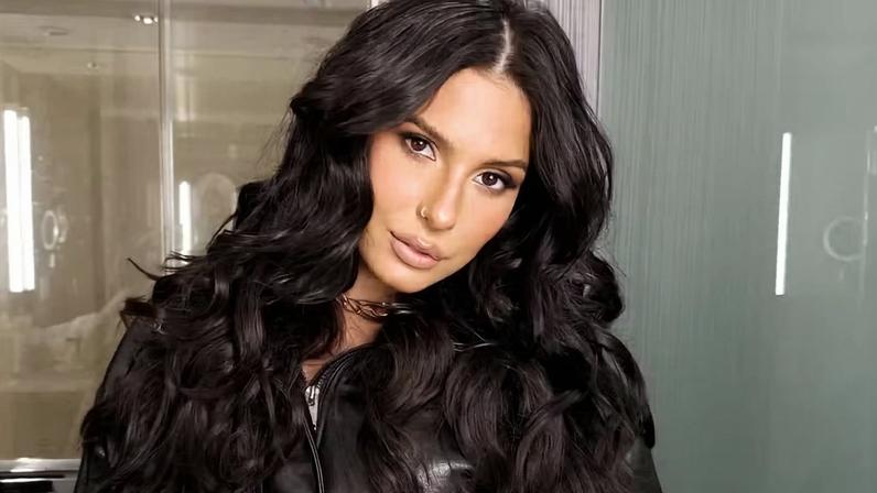 Ana Castela atualiza quadro de saúde e diz que conjuntivite se espalhou: 'Para o meu azar' — Foto: Reprodução/Instagram