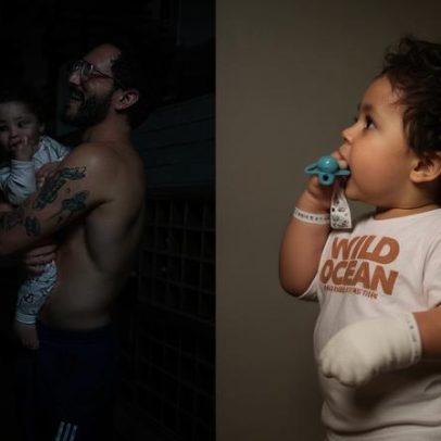 Ravi, filho de Viih Tube e Eliezer, sofre queimadura de 2º grau e faz cirurgia